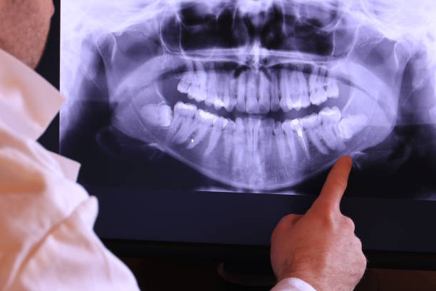 Best Emergency Treatment for Oral Infections in Bolivar Peninsula, TX
